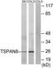 Tetraspanin 8 antibody, TA314631, Origene, Western Blot image 