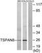 Tetraspanin-8 antibody, TA314631, Origene, Western Blot image 