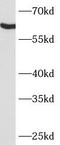 Arylsulfatase G antibody, FNab00612, FineTest, Western Blot image 