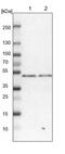 Double PHD Fingers 2 antibody, PA5-54274, Invitrogen Antibodies, Western Blot image 