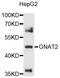 G Protein Subunit Alpha Transducin 2 antibody, abx125887, Abbexa, Western Blot image 
