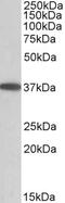 Proteasome Subunit Beta 3 antibody, 42-647, ProSci, Enzyme Linked Immunosorbent Assay image 