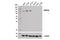 Inositol Polyphosphate-4-Phosphatase Type II B antibody, 14543T, Cell Signaling Technology, Western Blot image 