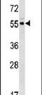 Protein Kinase C And Casein Kinase Substrate In Neurons 3 antibody, PA5-15356, Invitrogen Antibodies, Western Blot image 