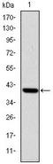 IL2 Inducible T Cell Kinase antibody, AM06655SU-N, Origene, Western Blot image 