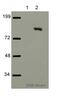 Poly(ADP-Ribose) Polymerase 1 antibody, ab4830, Abcam, Western Blot image 