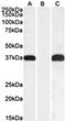 Pim-2 Proto-Oncogene, Serine/Threonine Kinase antibody, orb131689, Biorbyt, Western Blot image 