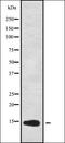 Cystatin M/E antibody, orb338222, Biorbyt, Western Blot image 