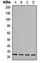 Fibroblast Growth Factor 6 antibody, abx121604, Abbexa, Western Blot image 