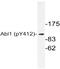 ABL Proto-Oncogene 1, Non-Receptor Tyrosine Kinase antibody, AP20872PU-N, Origene, Western Blot image 