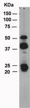 Matrix Metallopeptidase 12 antibody, ab52897, Abcam, Western Blot image 