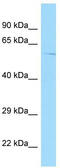 G Protein-Coupled Receptor 22 antibody, TA338157, Origene, Western Blot image 