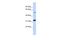 Tandem C2 Domains, Nuclear antibody, A14540, Boster Biological Technology, Western Blot image 