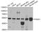 Pannexin 1 antibody, STJ28766, St John