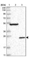 Deleted In Primary Ciliary Dyskinesia Homolog (Mouse) antibody, NBP2-38312, Novus Biologicals, Western Blot image 