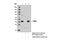 Tribbles Pseudokinase 2 antibody, 13533S, Cell Signaling Technology, Immunoprecipitation image 