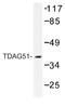 Pleckstrin Homology Like Domain Family A Member 1 antibody, AP01186PU-N, Origene, Western Blot image 