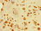 Tubulointerstitial Nephritis Antigen Like 1 antibody, LS-C398344, Lifespan Biosciences, Immunohistochemistry paraffin image 