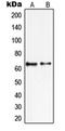 Protein Inhibitor Of Activated STAT 2 antibody, orb214852, Biorbyt, Western Blot image 