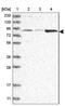 ATPase Family AAA Domain Containing 2B antibody, NBP1-89611, Novus Biologicals, Western Blot image 