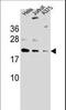 ADP Ribosylation Factor Like GTPase 6 Interacting Protein 6 antibody, LS-C159118, Lifespan Biosciences, Western Blot image 