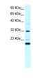 Rho GDP Dissociation Inhibitor Gamma antibody, orb329751, Biorbyt, Western Blot image 