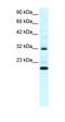 Rho GDP Dissociation Inhibitor Gamma antibody, orb329751, Biorbyt, Western Blot image 