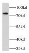 Transforming Growth Factor Beta Receptor Associated Protein 1 antibody, FNab08646, FineTest, Western Blot image 
