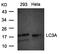 Microtubule Associated Protein 1 Light Chain 3 Alpha antibody, orb14704, Biorbyt, Western Blot image 