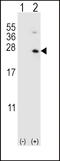 Hypoxanthine Phosphoribosyltransferase 1 antibody, LS-C165003, Lifespan Biosciences, Western Blot image 