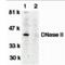 Deoxyribonuclease-2-alpha antibody, NBP1-76971, Novus Biologicals, Western Blot image 