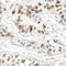 BRCA1 DNA Repair Associated antibody, abx000365, Abbexa, Immunohistochemistry frozen image 