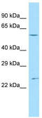 Ankyrin Repeat Domain 13C antibody, TA346642, Origene, Western Blot image 