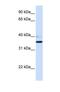 Beta-1,3-Galactosyltransferase 1 antibody, NBP1-69327, Novus Biologicals, Western Blot image 