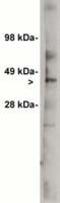 UDP-Glucose Ceramide Glucosyltransferase antibody, PA1-12760, Invitrogen Antibodies, Western Blot image 