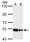 Serine Hydroxymethyltransferase 2 antibody, NBP2-20354, Novus Biologicals, Western Blot image 