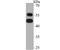 Nuclear Factor I B antibody, NBP2-75590, Novus Biologicals, Western Blot image 
