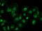 DExD-Box Helicase 39B antibody, MA5-25115, Invitrogen Antibodies, Immunocytochemistry image 
