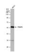 TNF Receptor Associated Factor 6 antibody, NBP1-33357, Novus Biologicals, Western Blot image 