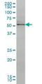 Nuclear Receptor Subfamily 4 Group A Member 2 antibody, H00004929-M08, Novus Biologicals, Western Blot image 