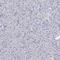 Oxysterol Binding Protein Like 6 antibody, HPA032131, Atlas Antibodies, Immunohistochemistry paraffin image 