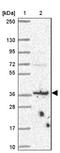 BR Serine/Threonine Kinase 1 antibody, NBP2-38935, Novus Biologicals, Western Blot image 