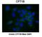 Carnitine Palmitoyltransferase 1B antibody, orb330486, Biorbyt, Immunohistochemistry paraffin image 