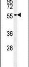 Perilipin 2 antibody, PA5-25042, Invitrogen Antibodies, Western Blot image 