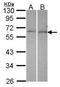 Dual Specificity Phosphatase 10 antibody, GTX115564, GeneTex, Western Blot image 