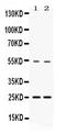 Vesicle Associated Membrane Protein 7 antibody, PB10017, Boster Biological Technology, Western Blot image 