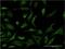 Phosphorylase Kinase Catalytic Subunit Gamma 2 antibody, H00005261-M05, Novus Biologicals, Immunofluorescence image 