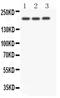 Notch Receptor 4 antibody, PA5-79749, Invitrogen Antibodies, Western Blot image 