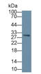 V-Set Domain Containing T Cell Activation Inhibitor 1 antibody, LS-C728353, Lifespan Biosciences, Western Blot image 