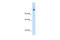 Carbamoyl-Phosphate Synthase 1 antibody, 30-096, ProSci, Western Blot image 